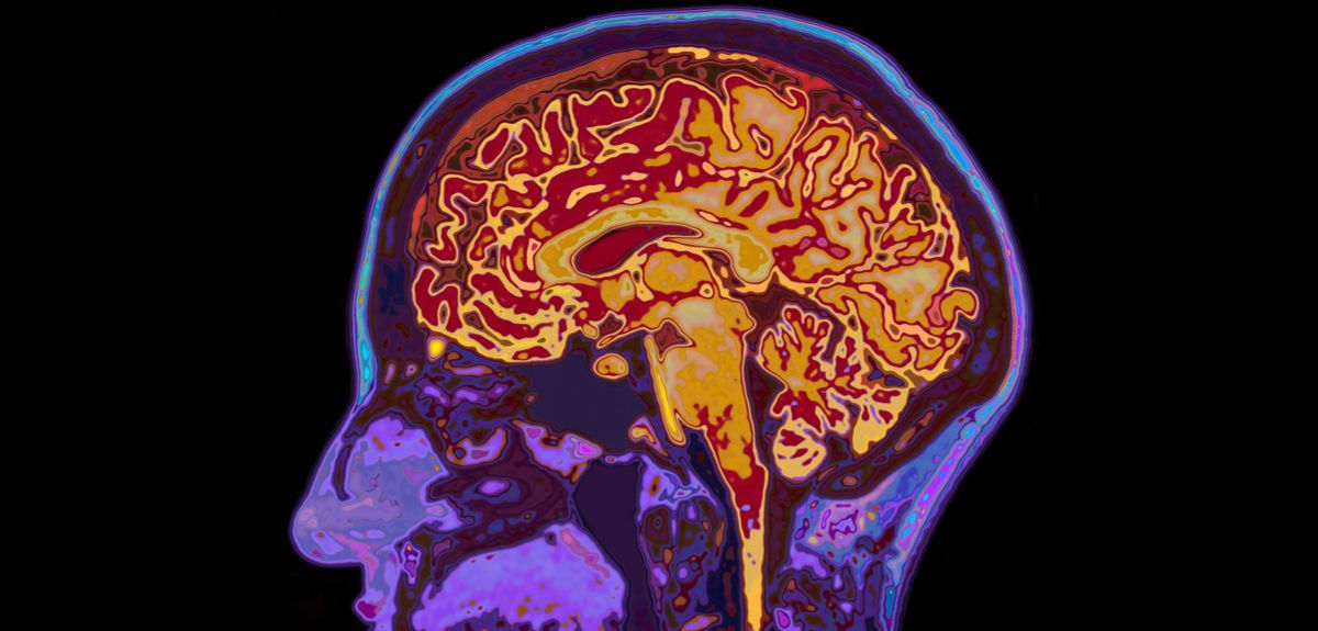 MRI Scans Reveal How Brain Protects Memories University Of Oxford MRI Scans Reveal How Brain Protects Memories University Of Oxford